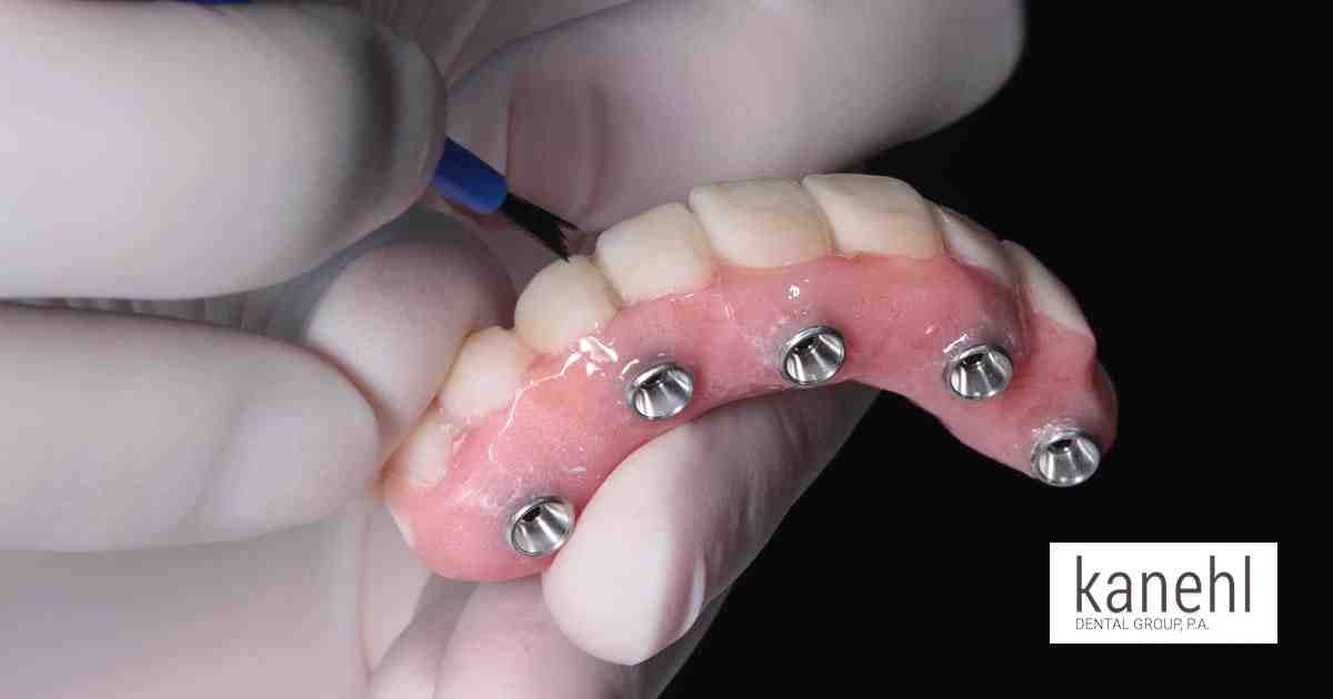 Do gums attach to dental implants?