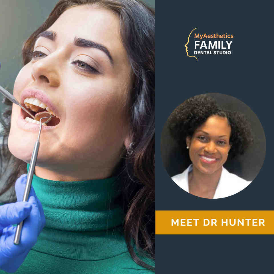 Do your teeth rot under veneers?