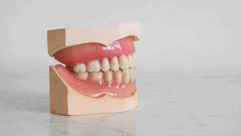 Does FL Medicaid cover dental implants?