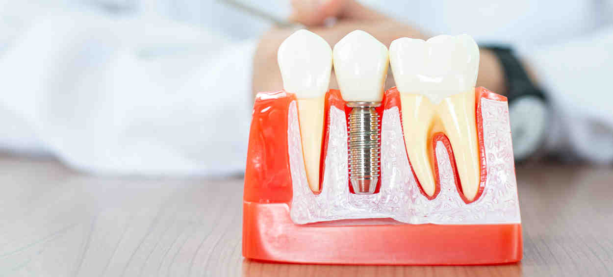Does a dental implant abutment hurt?