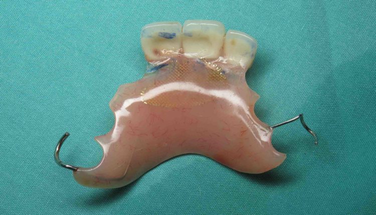Does clear choice have different technique in all on 4 dental implants