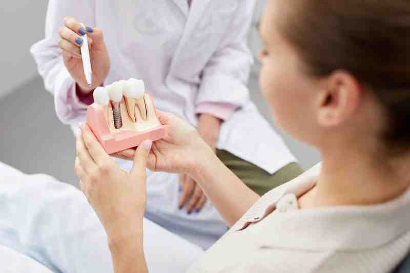 Does smoking cause implants to fail?
