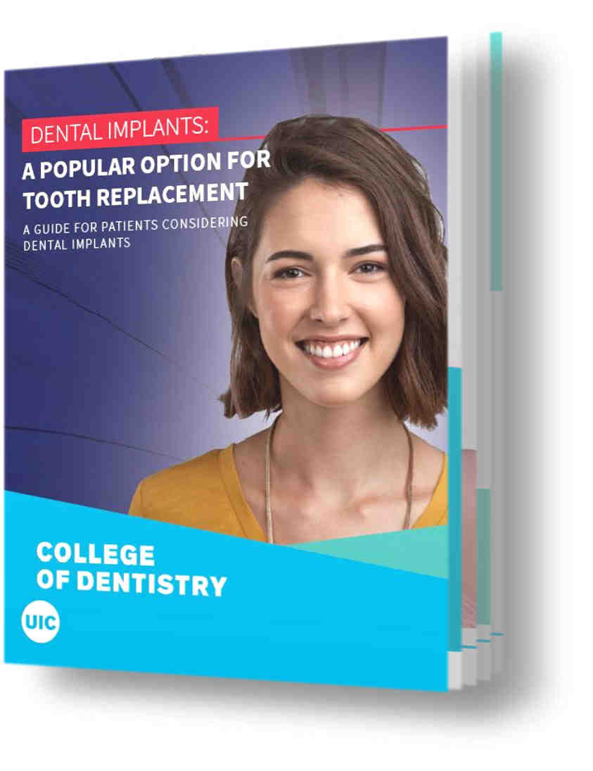 How can I keep my dental implants white?