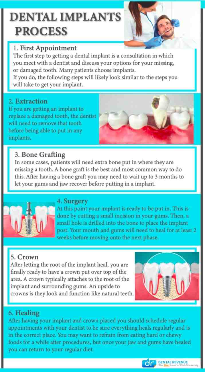 How can you tell if a dental implant is loose?