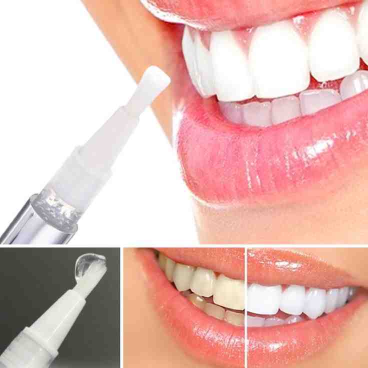 How do you brush around implants?