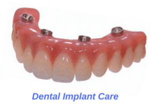 How do you clean a new implant?