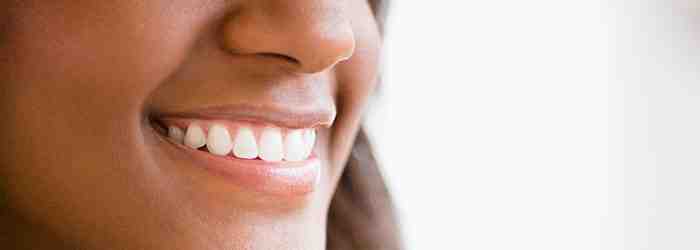 How do you clean permanent implants?