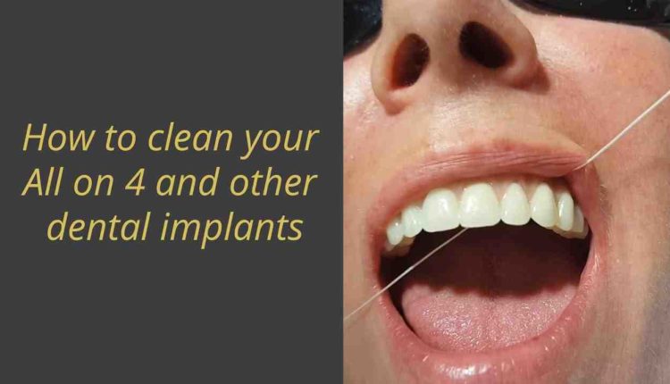 How do you clean under dental implants