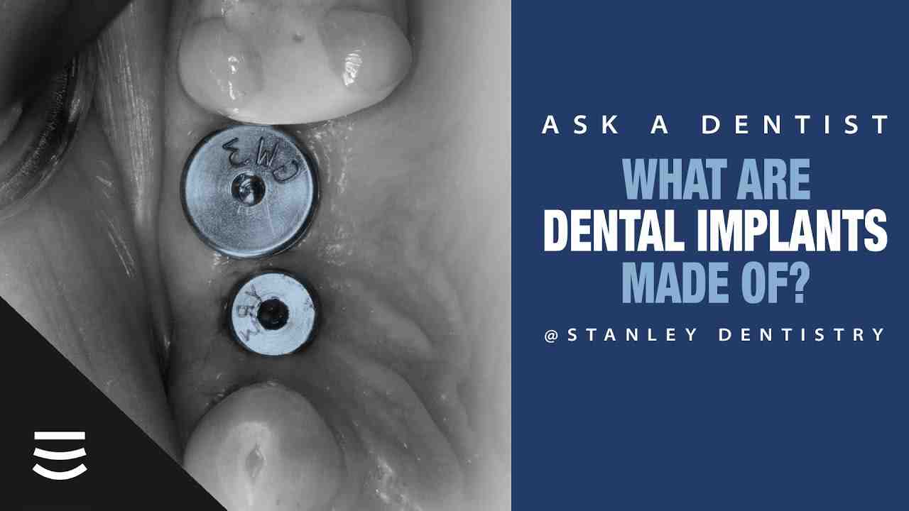 How do you know if your body is rejecting a tooth implant?