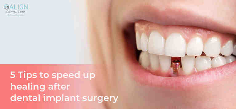 How do you know your implant is failing?