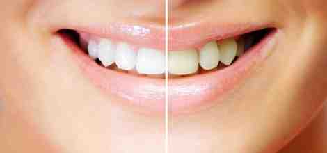 How do you sleep with a toothache?