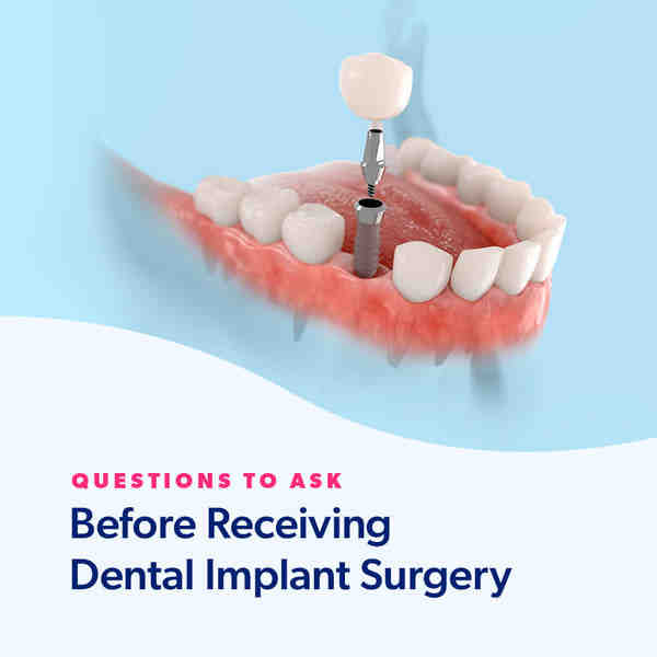 how-long-can-wait-dental-implant-dental-news-network