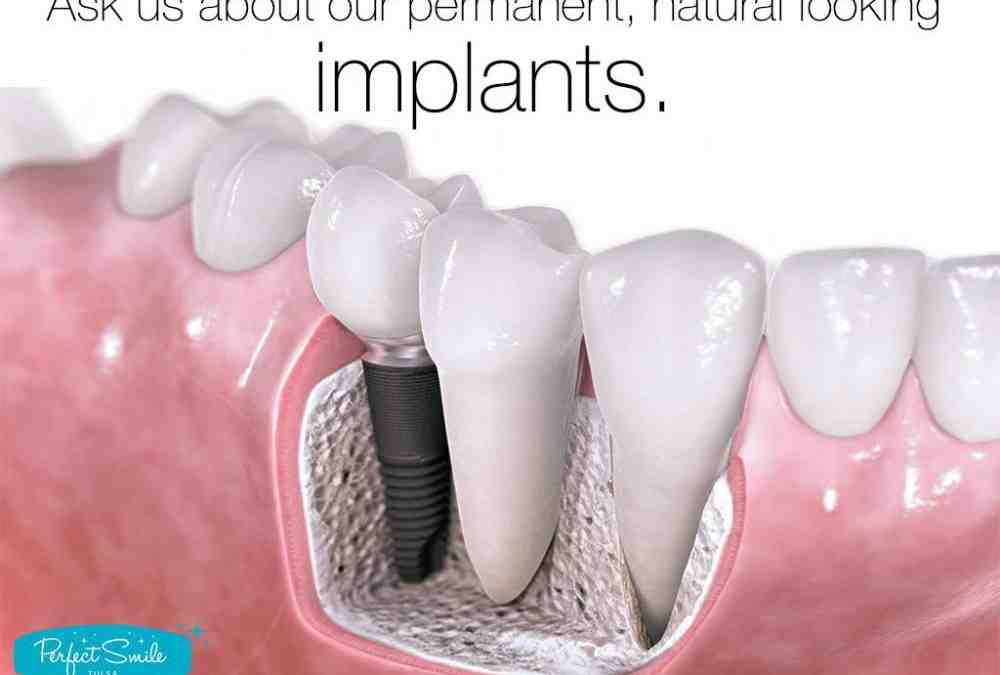 How long does the pain last after a dental implant?