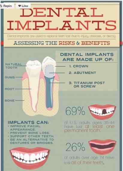 How long is dental school in California?