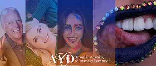 How many veneers shaved teeth?