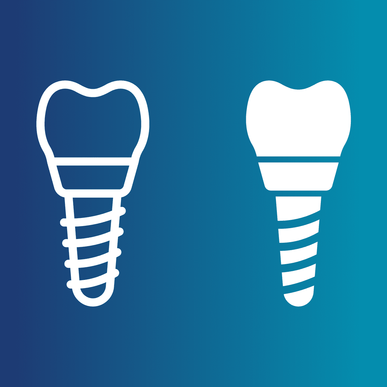 How much are veneers in East TN?