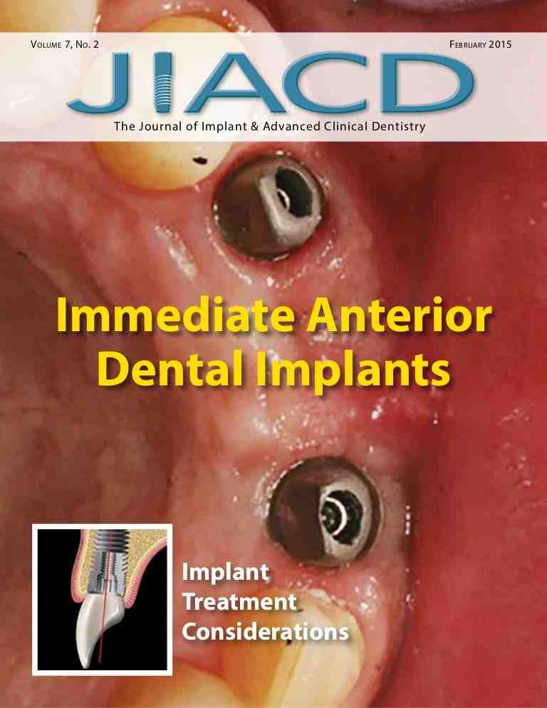How much do full mouth dental implants cost in Florida?
