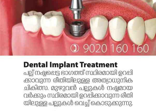 How much for dental implants the average per tooth in nyc met life