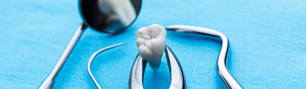 How much is a dental implant?