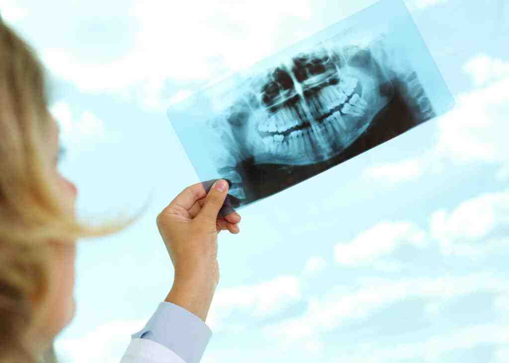How much is a dental implant?