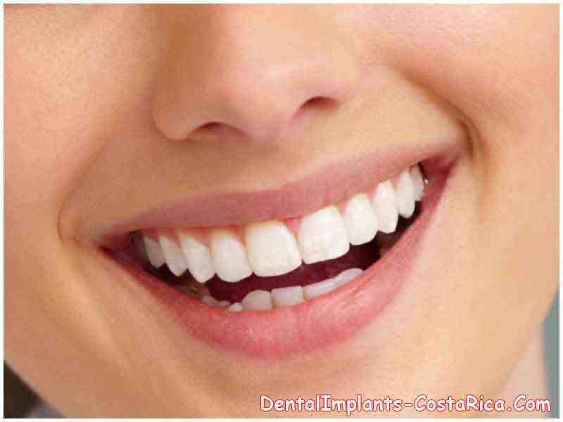 How much is it to get your teeth done in Costa Rica?
