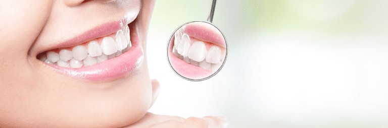 How much is the cheapest set of dental implants?