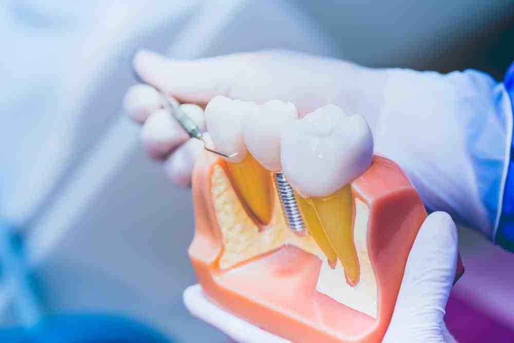 How painful is a tooth implant?