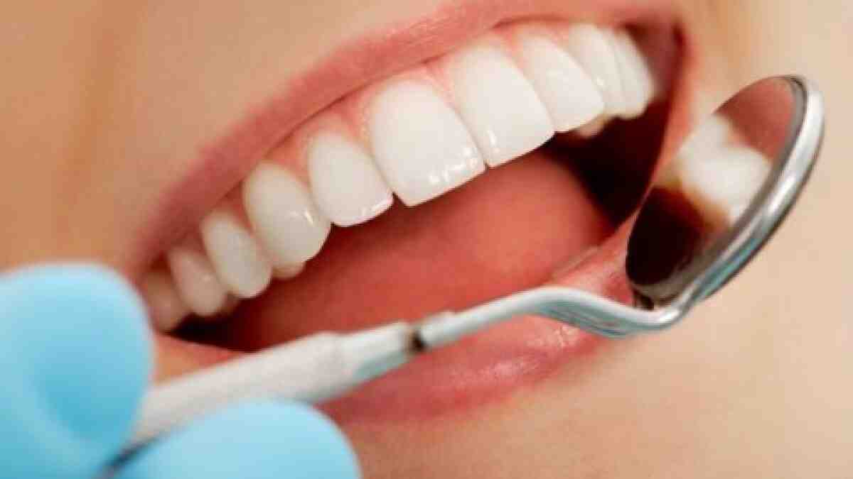 How should your mouth naturally rest?