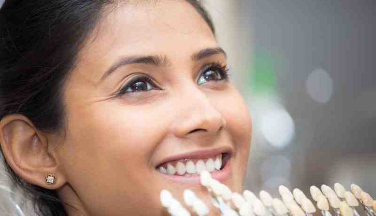 How to keep dental implants white