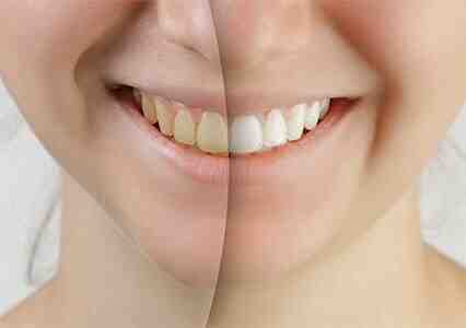Is Aspen Dental owned by private equity?