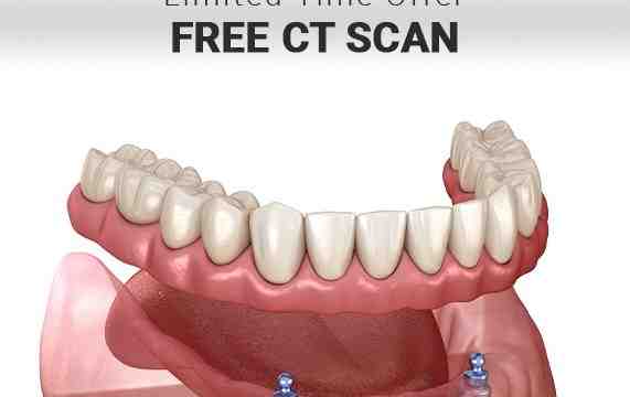 Is CBCT and OPG same?