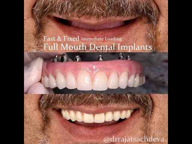 Is Sensodyne toothpaste a fluoride?