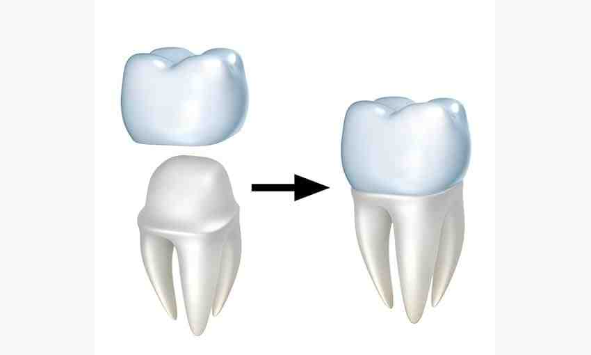 Is a cosmetic dentist the same as a regular dentist?
