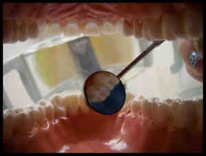 Is a tooth implant really necessary?