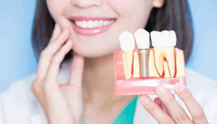 Is full dental implants give bad breath