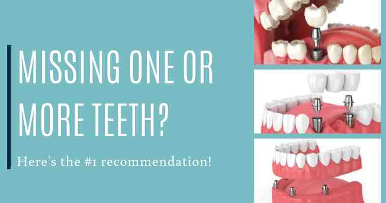 Is it better to get a bridge or implant?
