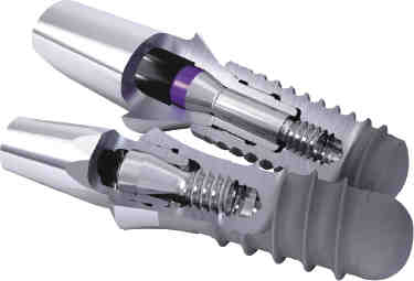 Is it better to get a bridge or implant?