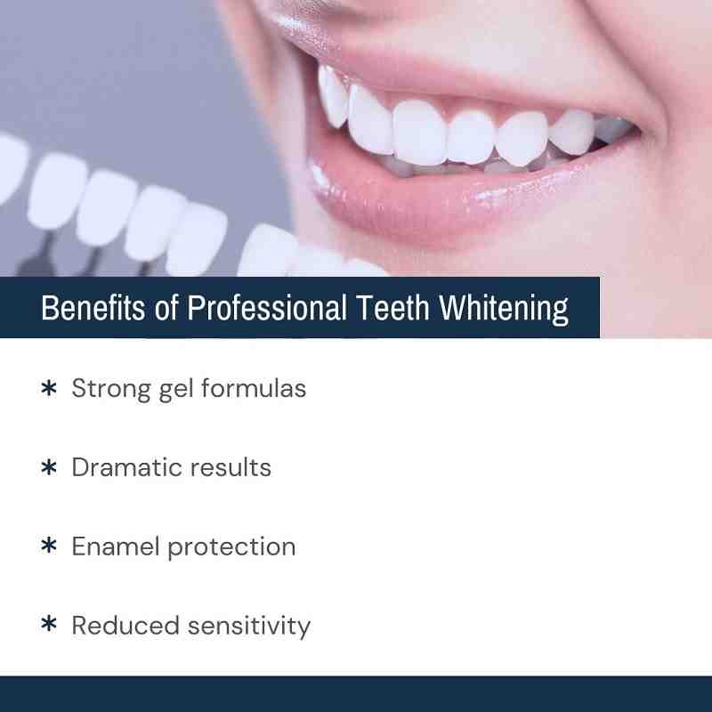 Is teeth whitening permanent?