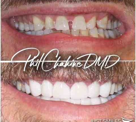 Just smiles family & cosmetic dentistry, 656 n state st, westerville, oh 43082