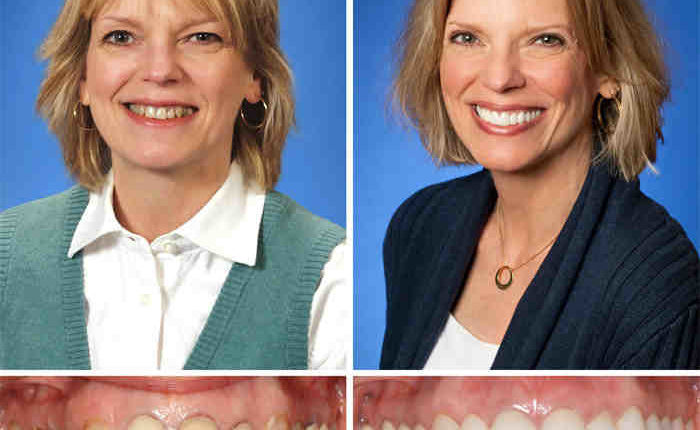 Lexington cosmetic dentistry