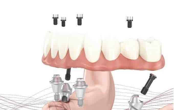 Marocco cosmetic & restorative dentistry