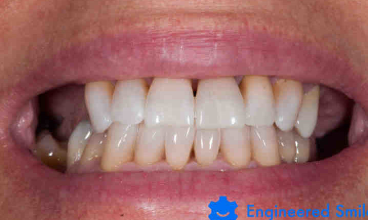 Natural smiles cosmetic dentistry marietta ga