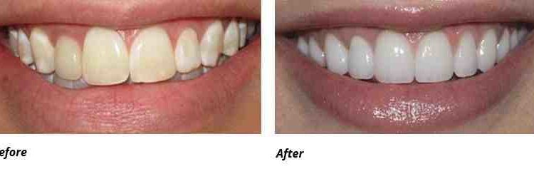 New york academy of cosmetic dentistry