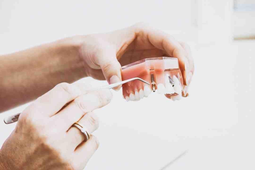 Should I stop taking apixaban before tooth extraction?