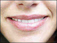 Should your teeth be touching when your mouth is closed?