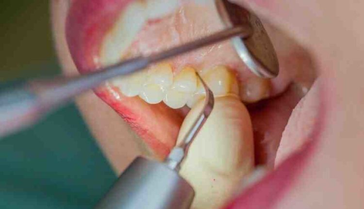 Ultrasound for dental implants?