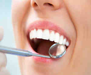 What are disadvantages of veneers?