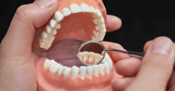 What are other options to dentures?