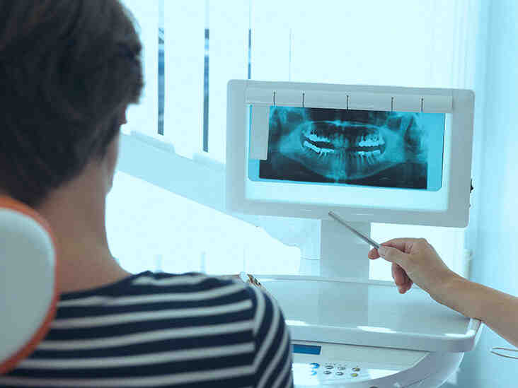 What are the 2 main types of dental implants today?