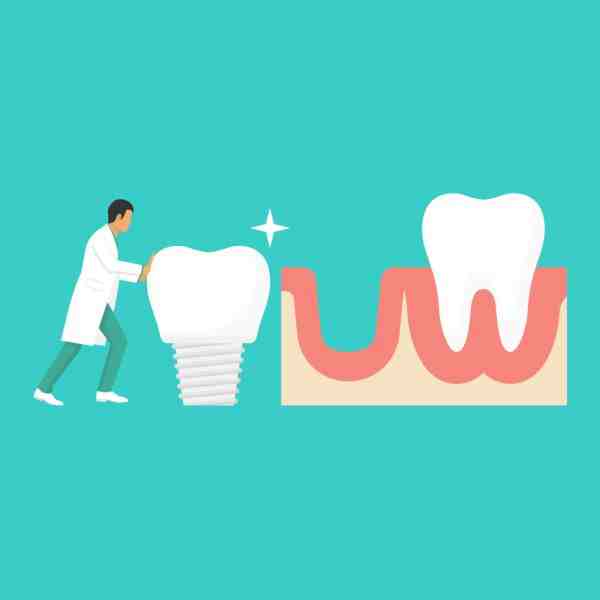 What are the 3 types of dental implants?